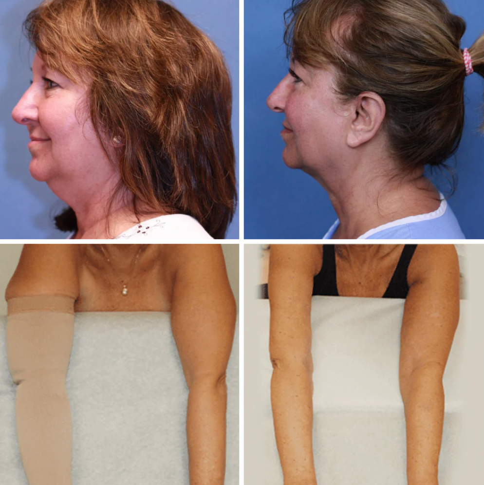 LYMARA Lymphatic Support Drops