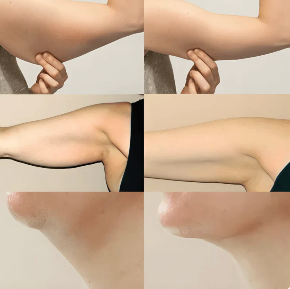 LYMARA Lymphatic Support Drops