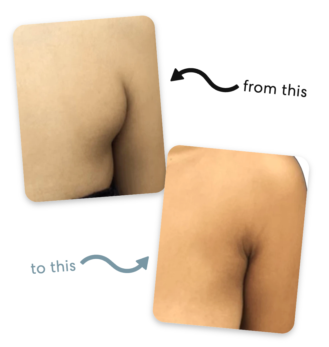 LYMARA Lymphatic Support Drops